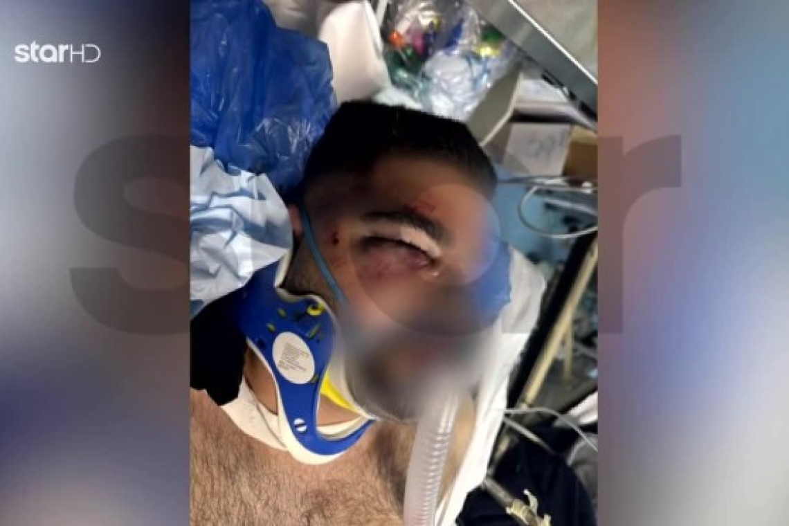 Καταγγελία αστυνομικής βίας στην Κηφισιά: Σοβαρό περιστατικό με 20χρονο