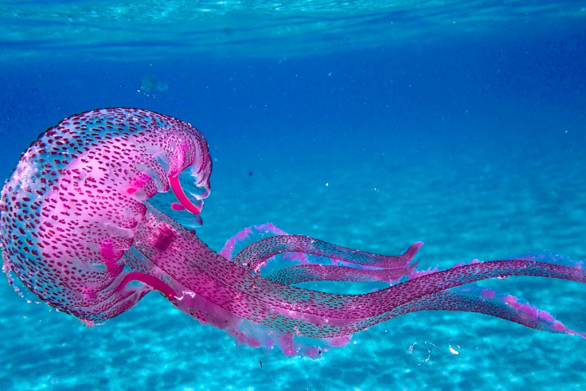 Τι πρέπει να κάνετε αν σας τσιμπήσει ροζ ή μπλε μέδουσα