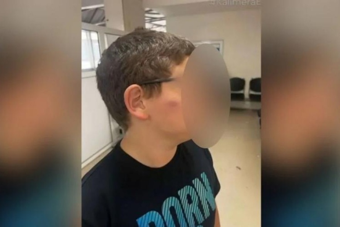 Έρευνα για ξυλοδαρμό 11χρονου μαθητή σε σχολείο της Θεσσαλονίκης